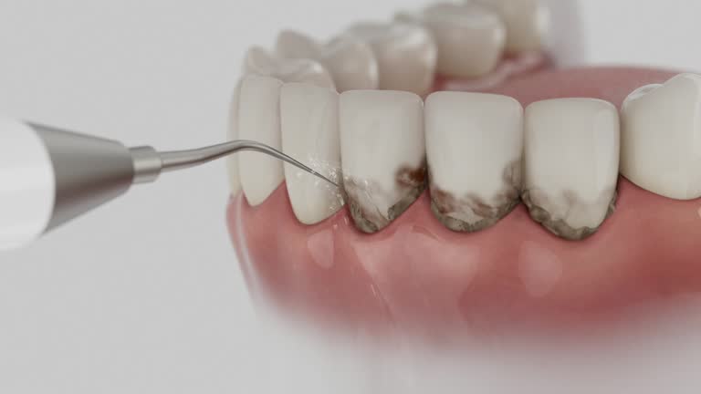 Trusted Dental Implants service in Abernathy, TX - Dentist Open Now
